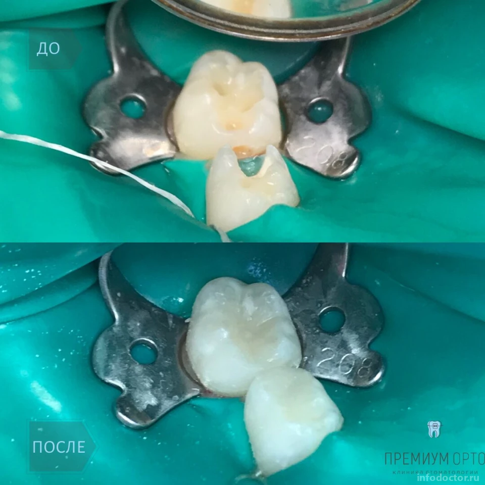 Стоматологическая клиника Премиум Орто: запись на прием, телефон, адрес,  отзывы цены и скидки на InfoDoctor.ru