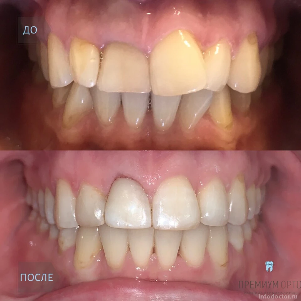 Стоматологическая клиника Премиум Орто: запись на прием, телефон, адрес,  отзывы цены и скидки на InfoDoctor.ru
